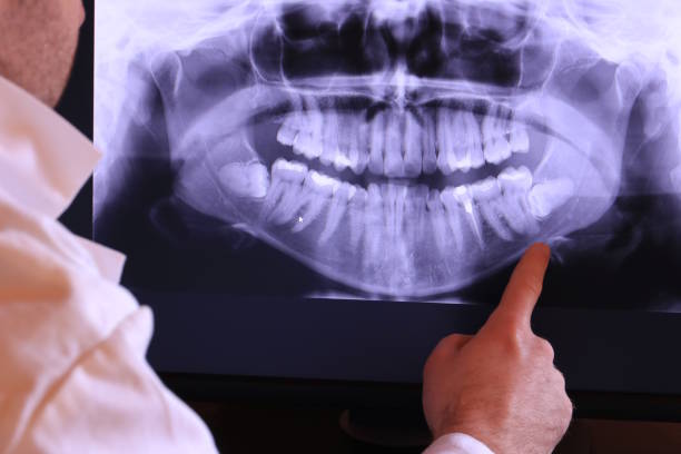 Best Emergency Dental Care for Trauma or Injury in Sayreville, NJ
